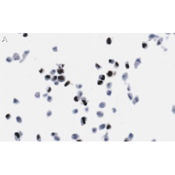 Anti-Cytomegalovirus Antibody, clone 8B1.2 ZooMAb® Mouse Monoclonal，25UL，ZMS1015-25UL，Sigma