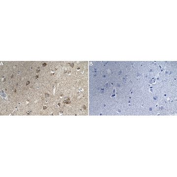 Anti-Neurexin-1-β Antibody, clone 1F14 ZooMAb® Rabbit Monoclonal，，ZRB2604-4X25UL，Sigma