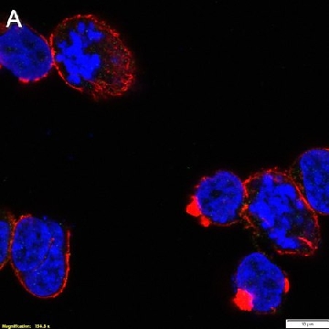 Anti-p-ZAP-70 (Tyr493) Antibody, clone 1F10 ZooMAb® Rabbit Monoclonal，4X25UL，ZRB1718-4X25UL，Sigma