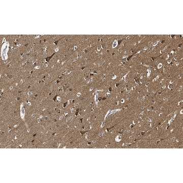Anti-Tau Antibody, clone 3D20 ZooMAb® Rabbit Monoclonal，25UL，ZRB1092-25UL，Sigma