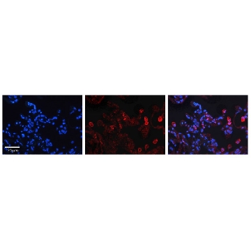 Anti-DEGS1 antibody produced in rabbit，100UL，SAB2100559-100UL，Sigma