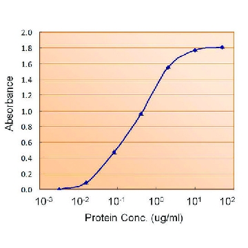 Anti-TTR antibody produced in goat，100UG，SAB2501931-100UG，Sigma