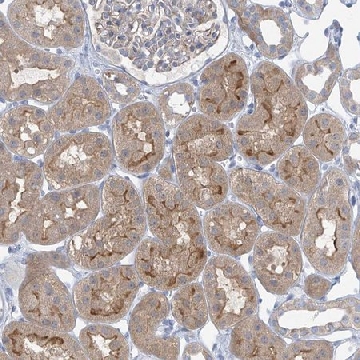 Anti-SLC6A12 antibody produced in rabbit，100UL，HPA034973-100UL，Sigma