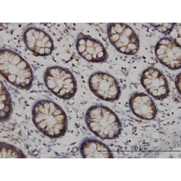 Monoclonal Anti-TYK2 antibody produced in mouse，100UG，WH0007297M1-100UG，Sigma