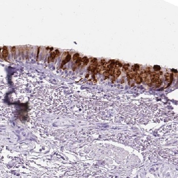 Anti-SCGB1A1 antibody produced in rabbit，100UL，HPA031828-100UL，Sigma