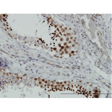 Monoclonal Anti-HMGB2 antibody produced in mouse，100UG，WH0003148M5-100UG，Sigma