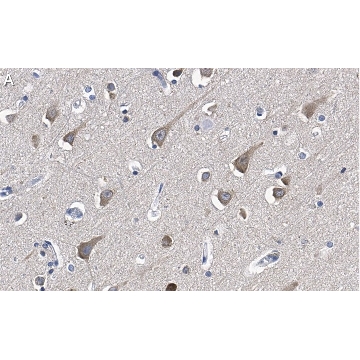 Anti-LC3A Antibody, clone 3J12 ZooMAb® Rabbit Monoclonal，25UL，ZRB1125-25UL，Sigma