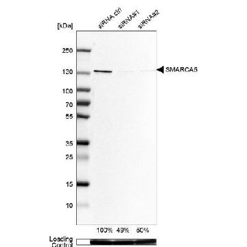 Anti-SMARCA5 antibody produced in rabbit，100UL，HPA008751-100UL，Sigma