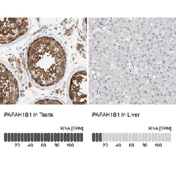 Anti-PAFAH1B1 antibody produced in rabbit，100UL，HPA020036-100UL，Sigma