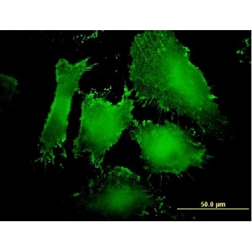 Monoclonal Anti-MAGI1 antibody produced in mouse，100UG，WH0009223M3-100UG，Sigma