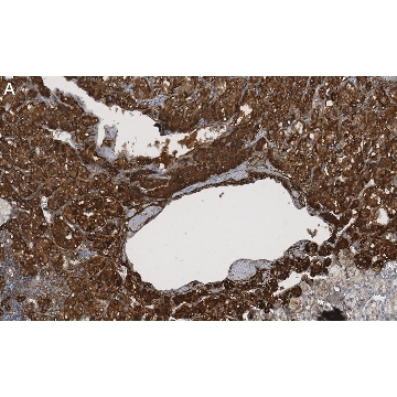 Anti-Clusterin α chain Antibody, clone 41D ZooMAb® Mouse Monoclonal，25UL，ZMS1049-25UL，Sigma