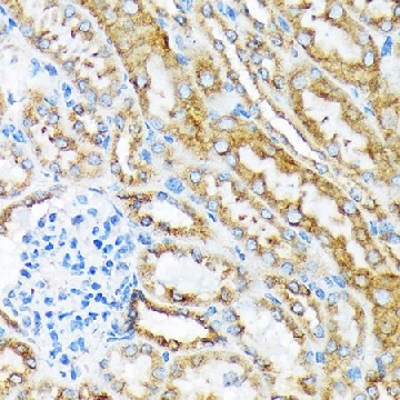Anti-MSP/MST1 antibody produced in rabbit，100UL，SAB5700866-100UL，Sigma