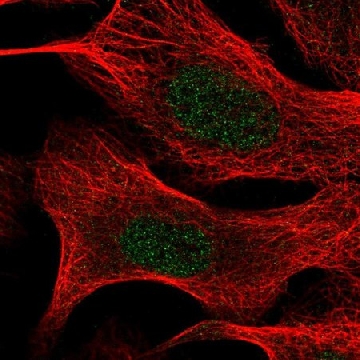 Anti-TIA1 antibody produced in rabbit，100UL，HPA056961-100UL，Sigma