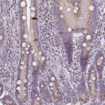Anti-MAN1B1 antibody produced in rabbit，100UL，HPA051516-100UL，Sigma