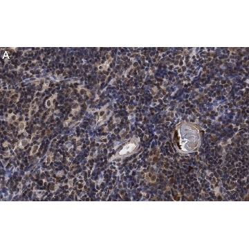 Anti-RORγ Antibody, clone 6F3.1 ZooMAb® Mouse Monoclonal，25UL，ZMS1074-25UL，Sigma