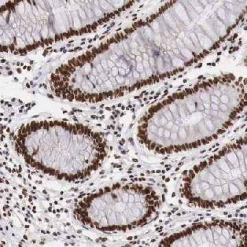 Anti-PHF14 antibody produced in rabbit，100UL，HPA000538-100UL，Sigma