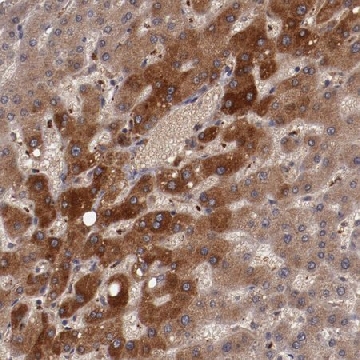 Anti-CP antibody produced in rabbit，100UL，HPA001834-100UL，Sigma