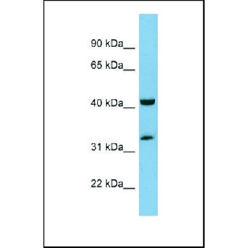 Anti-RAGE, (N-terminal) antibody produced in rabbit，100UL，SAB2105049-100UL，Sigma