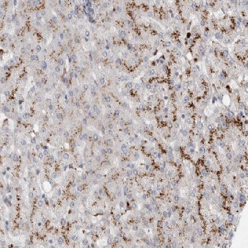 Anti-GAA antibody produced in rabbit，100UL，HPA026970-100UL，Sigma