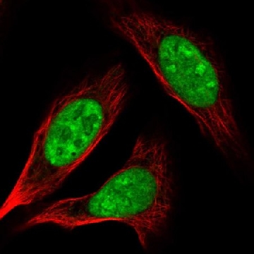 Anti-AK6 antibody produced in rabbit，100UL，HPA034935-100UL，Sigma