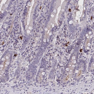 Anti-MRGPRX2 antibody produced in rabbit，100UL，HPA055220-100UL，Sigma