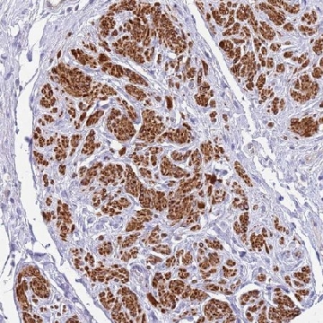 Anti-MVD antibody produced in rabbit，100UL，HPA048250-100UL，Sigma