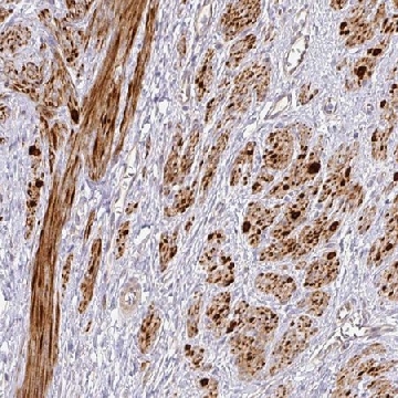 Anti-TARM1 antibody produced in rabbit，100UL，HPA051022-100UL，Sigma