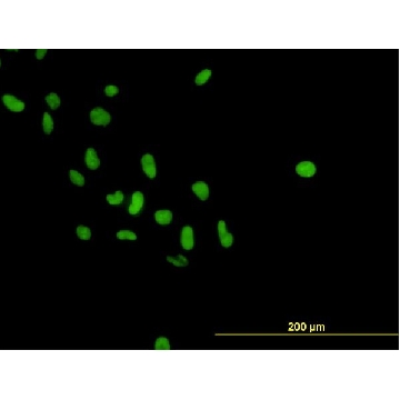 Monoclonal Anti-PARP1 antibody produced in mouse，100UG，WH0000142M1-100UG，Sigma
