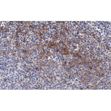 Anti-TGFBR2 Antibody, clone 1N11 ZooMAb® Rabbit Monoclonal，25UL，ZRB1722-25UL，Sigma