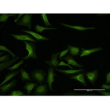 Monoclonal Anti-MAGEA3 antibody produced in mouse，100UG，SAB1404045-100UG，Sigma