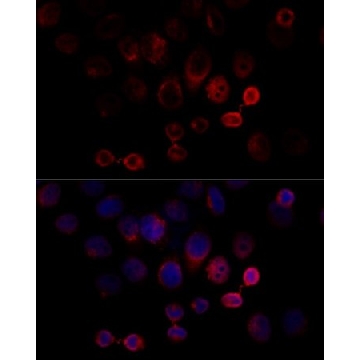 Anti-Caspase 3 antibody produced in rabbit，100UL，SAB5700196-100UL，Sigma