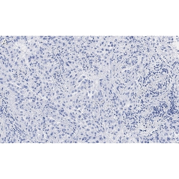 Anti-Integrin αVβ8 Antibody, clone EM13309 , ZooMAb® Rabbit Monoclonal，4X25UL，ZRB1192-4X25UL，Sigma