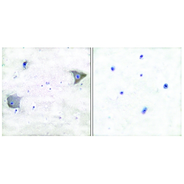 Anti-PDGFR α antibody produced in rabbit，100UG，SAB4502142-100UG，Sigma