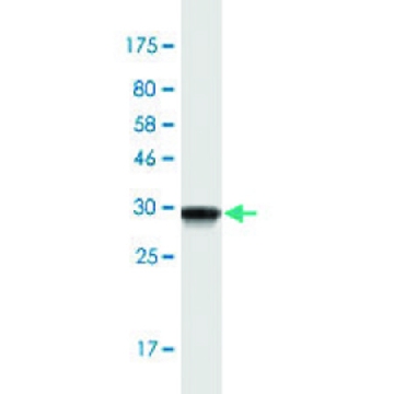 Monoclonal Anti-PKIB antibody produced in mouse，100UG，SAB1412738-100UG，Sigma
