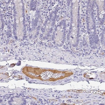 Anti-APOB antibody produced in rabbit，100UL，HPA049793-100UL，Sigma