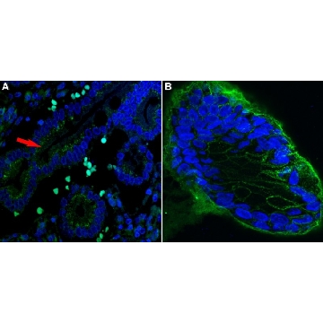 Anti-MUC5AC Antibody, clone CLH2 ZooMAb® Mouse Monoclonal，25UL，ZMS1133-25UL，Sigma