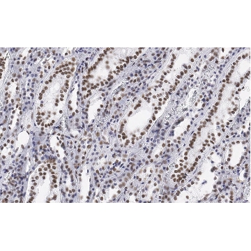Anti-CDC5L Antibody, clone 4F8 ZooMAb® Rabbit Monoclonal，25UL，ZRB1067-25UL，Sigma