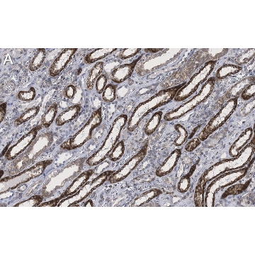 Anti-DR5/CD262 Antibody, clone 1B19 ZooMAb® Rabbit Monoclonal，25UL，ZRB1777-25UL，Sigma