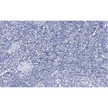 Anti-vWF Antibody, clone 1B21, ZooMAb® Rabbit Monoclonal，4X25UL，ZRB7356-4X25UL，Sigma