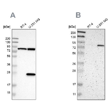Anti-ALDH18A1 antibody produced in rabbit，100UL，HPA012604-100UL，Sigma