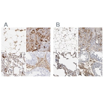 Anti-C3 antibody produced in rabbit，100UL，HPA003563-100UL，Sigma