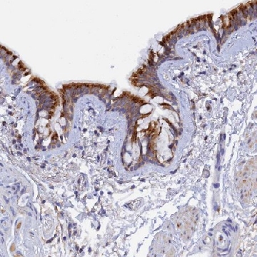 Anti-RPGRIP1L antibody produced in rabbit，100UL，HPA039405-100UL，Sigma