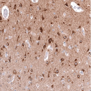 Anti-TTYH3 antibody produced in rabbit，100UL，HPA053520-100UL，Sigma