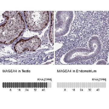 Anti-MAGEA4 antibody produced in rabbit，100UL，HPA021942-100UL，Sigma