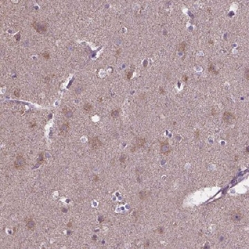Anti-FAM114A1 antibody produced in rabbit，100UL，HPA069701-100UL，Sigma