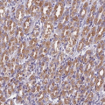 Anti-DDX51 antibody produced in rabbit，100UL，HPA039503-100UL，Sigma