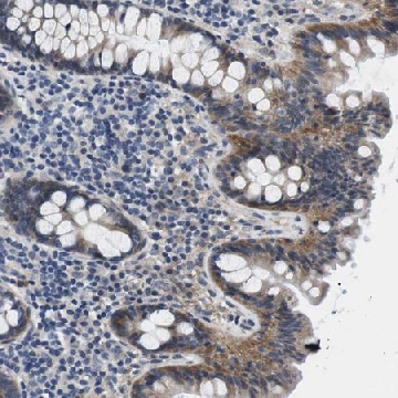 Anti-SLC30A1 antibody produced in rabbit，100UL，HPA015275-100UL，Sigma