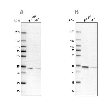 Anti-SFXN1 antibody produced in rabbit，100UL，HPA019543-100UL，Sigma