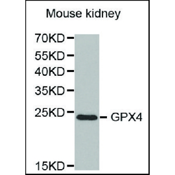 抗-GPX4 兔抗，100UL，SAB4300725-100UL，Sigma