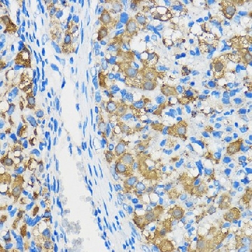 Anti-ATF6 antibody produced in rabbit，100UL，SAB5700037-100UL，Sigma